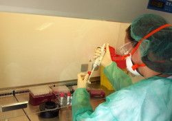 Cantabria confirma el primer caso de viruela del mono en un hombre de 31 a&ntilde;os