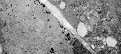 El ISCIII documenta los primeros casos en España de un enterovirus raro ligado a enfermedad respiratoria y neurológica