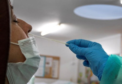  Espa&ntilde;a ha realizado m&aacute;s de 41,2 millones de pruebas diagn&oacute;sticas desde el inicio de la epidemia