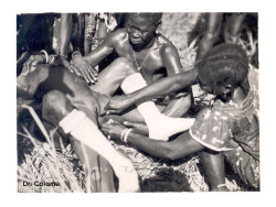 La ablación de nuevo