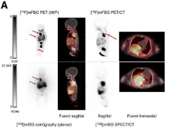 Una novedosa técnica detecta con precisión un tumor infantil en poco tiempo y sin anestesia, según un estudio
