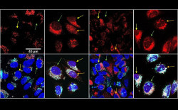 Una nueva estrategia frente al c&aacute;ncer consigue `in vitro` mayor muerte celular con menos quimioterapia