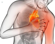 Actuar a tiempo en un infarto es "clave" para disminuir el da&ntilde;o en el tejido card&iacute;aco