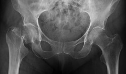 Carmen G&oacute;mez Vaquero, reumat&oacute;loga: "La prevenci&oacute;n de la osteoporosis debe empezar en la infancia"