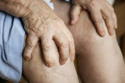 ConArtritis advierte del riesgo cardiovascular y la afectaci&oacute;n neurol&oacute;gica asociados a las enfermedades reum&aacute;ticas