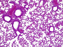 Crean una `píldora viva` para combatir infecciones pulmonares resistentes a antibióticos