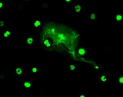 Descubren diferencias entre hombres y mujeres en la funci&oacute;n de las c&eacute;lulas inmunitarias