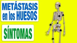 Descubren un factor que explica la propagaci&oacute;n de met&aacute;stasis a los huesos en el c&aacute;ncer de mama