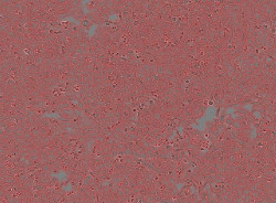 Descubren un nuevo linfocito que mata las c&eacute;lulas cancerosas