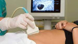 ¿EL ABORTO PUEDE SER UN DERECHO?  Por Juan Goti Ordeñana  Catedrático jubilado de la Universidad de Valladolid