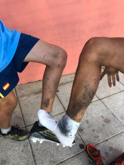 El PRC de Santander alerta de la "nueva presencia de caucho defectuoso" en el campo de El Regimiento