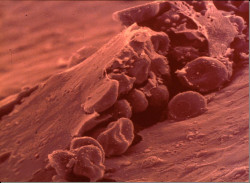 El rico colesterol, por el Dr  D. José Manuel Revuelta