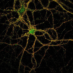 Encuentran una nueva diana terapéutica para las alteraciones psiquiátricas en la enfermedad de Niemann-Pick tipo C