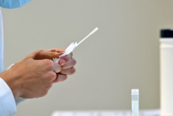 Espa&ntilde;a suma 10.843 casos y 206 muertes con COVID-19, mientras la incidencia en mayores sube 13 puntos