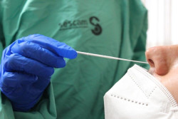  Espa&ntilde;a suma 30.615 casos y 288 muertes, mientras la incidencia baja 65 puntos hasta 919