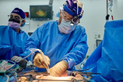 Estados Unidos documenta el caso más largo de funcionamiento de un riñón de cerdo en un cuerpo humano
