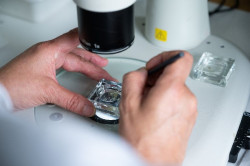 Expertos instan a la incorporación de España al Espacio Europeo de Datos Sanitarios para mejorar el abordaje del cáncer