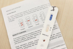  Farmacias piden autorizaci&oacute;n para realizar los tests r&aacute;pidos