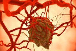 Ingenieros dise&ntilde;an nanopart&iacute;culas que estimulan el sistema inmunitario y lo ayudan a atacar tumores