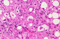 Investigadores ayudan a restablecer el equilibrio hormonal alterado en enfermedades metab&oacute;licas