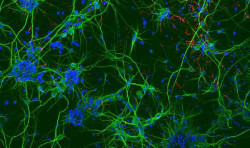 Investigadores del CSIC crean un hidrogel que permite cultivar células neurales para reparar lesiones medulares