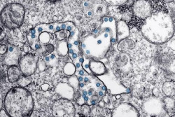 Investigadores del CSIC observan la implicaci&oacute;n del envejecimiento celular en los efectos del Covid-19