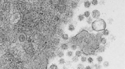 Investigadores espa&ntilde;oles desarrollan una vacuna intranasal que elimina el virus del Covid-19 en ratones