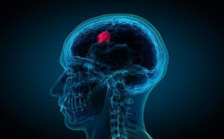 Investigadores españoles hallan un biomarcador que podría mejorar la inmunoterapia contra el glioblastoma