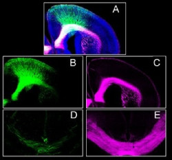 La ausencia del receptor CB1 en el desarrollo embrionario altera la formaci&oacute;n de la corteza prefrontal