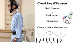 La estimulación cerebral puede ayudar a caminar mejor a los pacientes con Parkinson, según un estudio