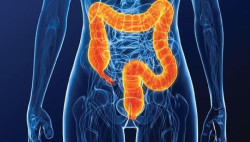 La inmunoterapia previa a la cirug&iacute;a puede hacer que el c&aacute;ncer de colon se reduzca sustanciamente o desparezca