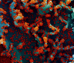 La microbi&oacute;loga Mar&iacute;a Tom&aacute;s pide tranquilidad ante la coinfecci&oacute;n flurona: "No es un virus nuevo ni una variante"