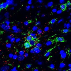 Los cient&iacute;ficos identifican el gen que primero ralentiza y luego acelera la progresi&oacute;n de la ELA, en ratones