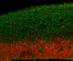 Los investigadores catalogan docenas de mutaciones en un gen crucial para el desarrollo del cerebro