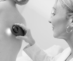 Los lunares comunes podr&iacute;an ayudar en la lucha contra el melanoma y en la prevenci&oacute;n de su reaparici&oacute;n