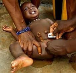 Mutilación genital en España