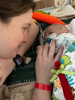 Primer trasplante de corazón parcial del mundo  Dr. José Manuel Revuelta  Catedrático de Cirugía. Profesor Emérito de la Universidad de Cantabria  