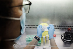 Sanidad confirma 242 casos positivos de viruela del mono y otros 486 sospechosos en Espa&ntilde;a