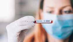  Sanidad notifica 8.114 nuevos casos de coronavirus y la incidencia asciende ligeramente hasta 155