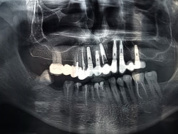 Sólo un metaverso suelto.Eduardo Madroñal