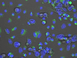 Un compuesto en investigación consigue reducir en ratones la metástasis en cáncer de mama