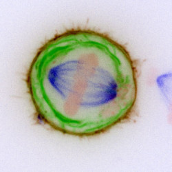 Un estudio identifica una causa clave de la formaci&oacute;n del c&aacute;ncer durante la divisi&oacute;n celular