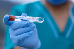 Un modelo matem&aacute;tico calcula que tan solo se han contabilizado 1 de cada 5 casos de COVID-19 a nivel mundial