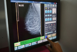 Una investigaci&oacute;n internacional apunta a un nuevo tratamiento eficaz contra el c&aacute;ncer de mama